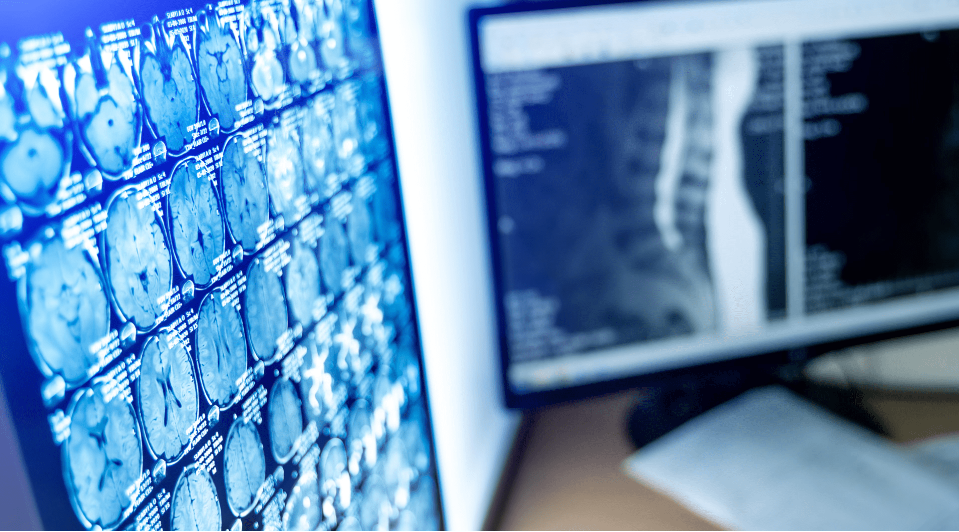 Radiografia digital ou convencional: entenda as vantagens e desvantagens